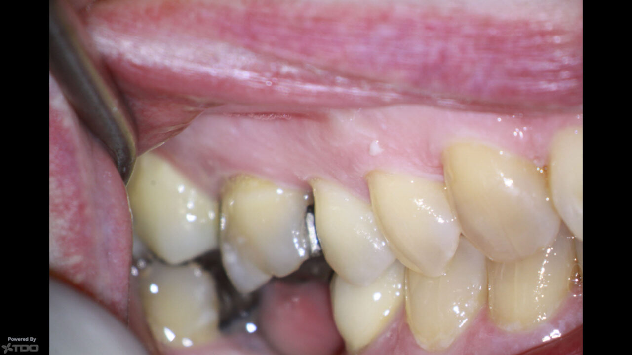 February 2021 Treatment Plan Considerations Prior to Referral Again