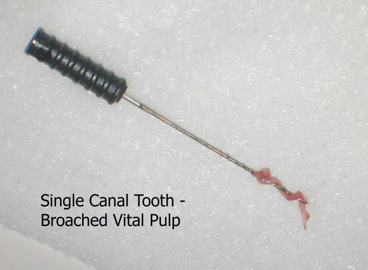 Clean and Shape EndoExperience